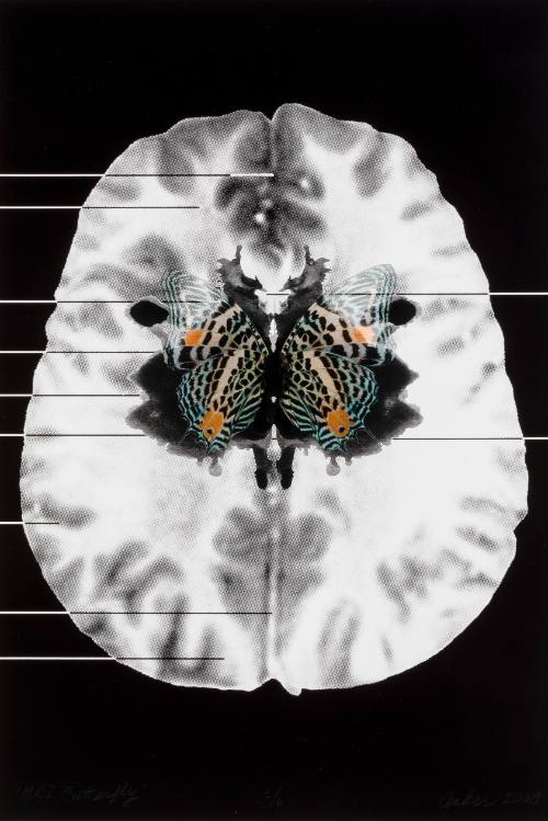 MRI Butterfly (5)